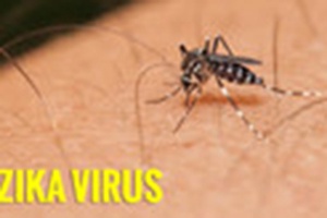 Trẻ sơ sinh dị tật đầu nhỏ do Zika đầu tiên tại New York