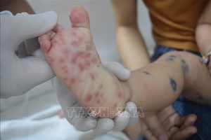 'Trường học chủ động phòng, chống bệnh tay chân miệng