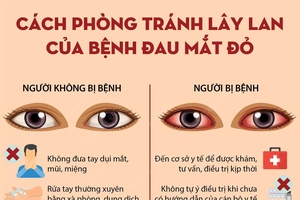 [Infographics] Cách phòng tránh lây lan của bệnh đau mắt đỏ